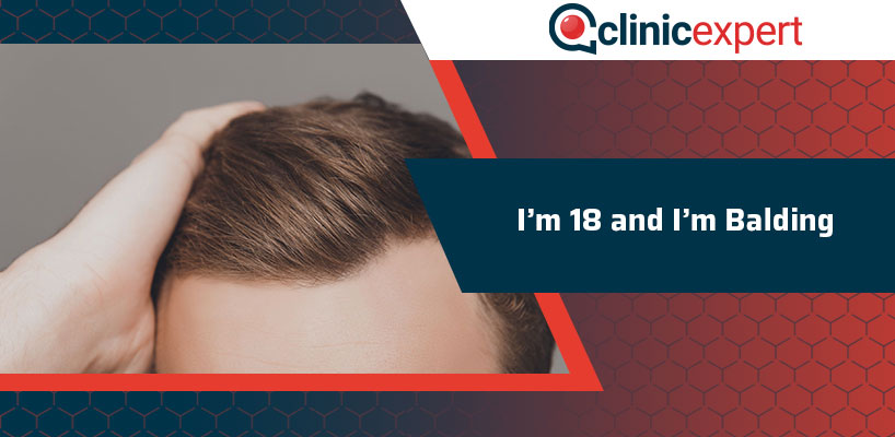 Balding at 18 deals