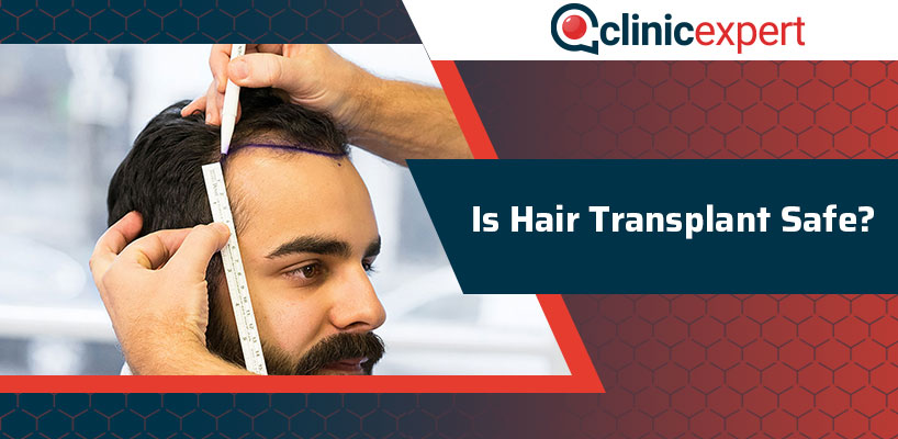 Is Hair Transplant Safe? | ClinicExpert