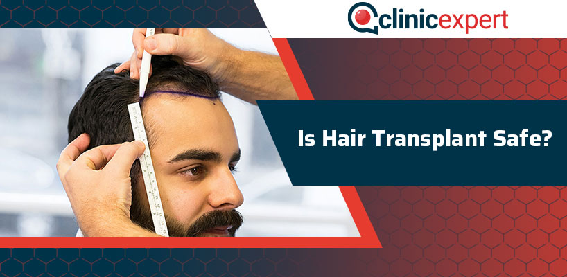 Is Hair Transplant Safe?