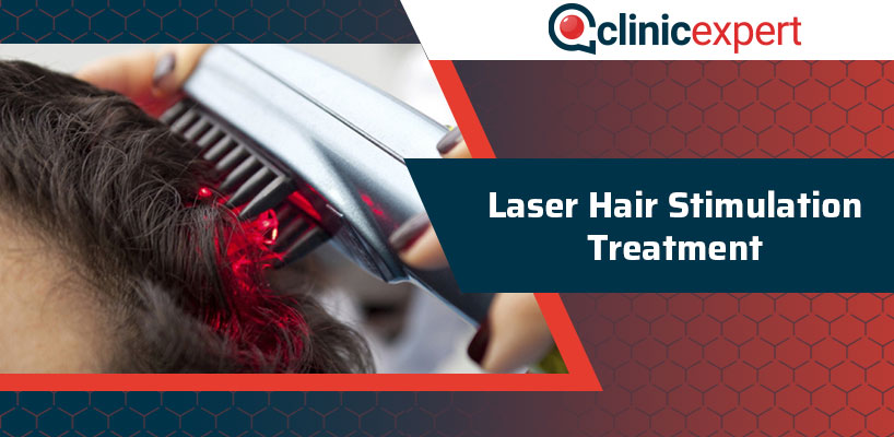 Laser Hair Stimulation