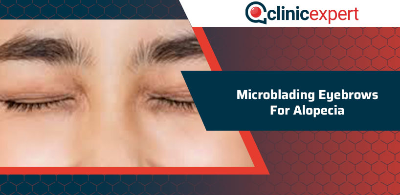 Microblading Eyebrows For Alopecia