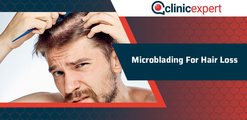 Microblading For Hair Loss