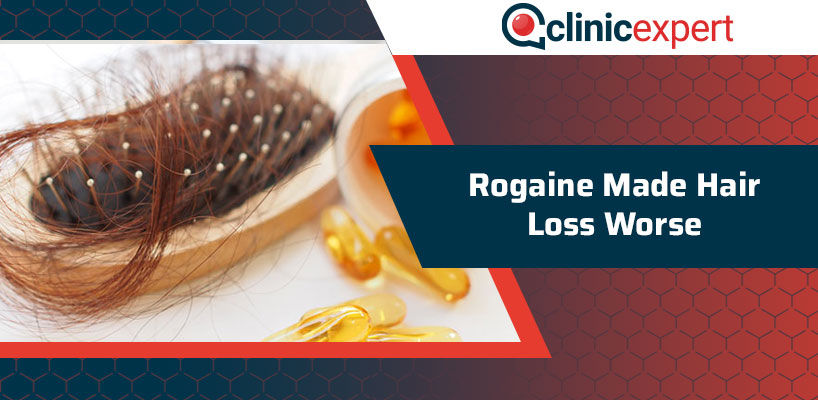 Rogaine Made Hair Loss Worse