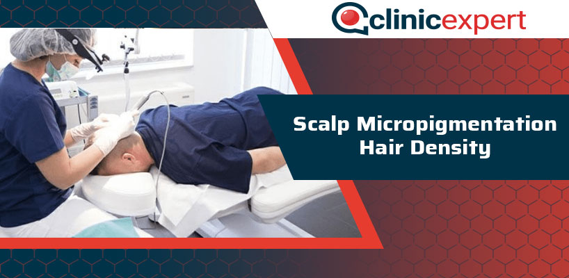 Scalp Micropigmentation Hair Density