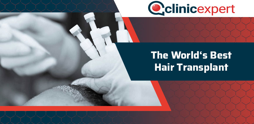 The World's Best Hair Transplant