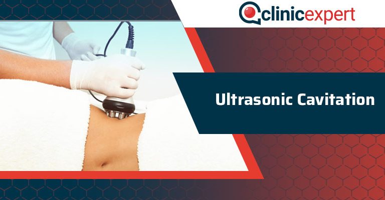 Ultrasonic Cavitation