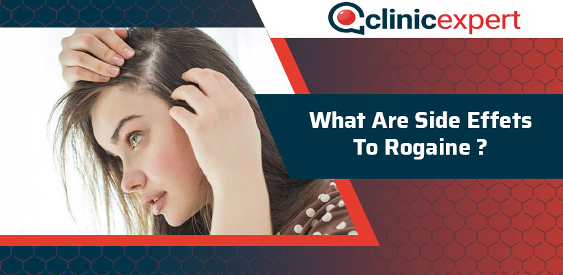 What Are The Side Effects To Rogaine?