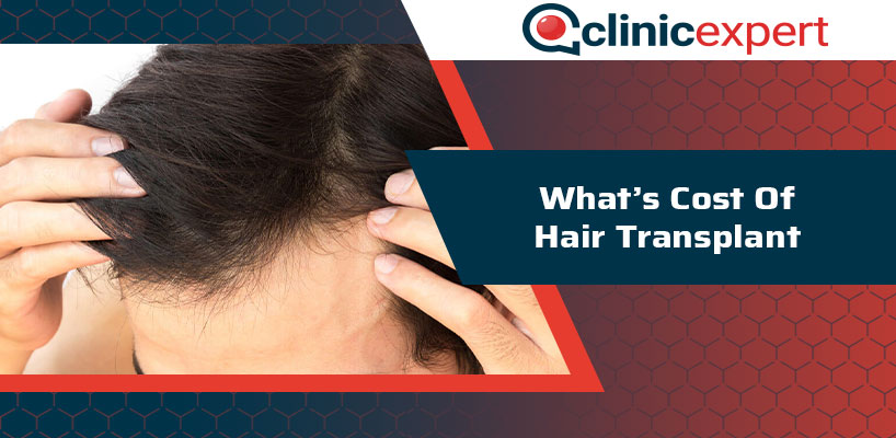 Women's Hair Transplant - Green DMC Travel Tour Agency