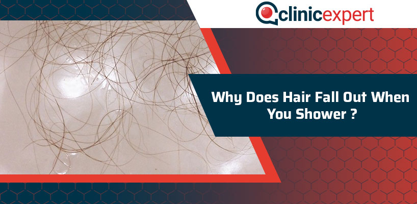 Why Does Hair Fall Out When You Shower?