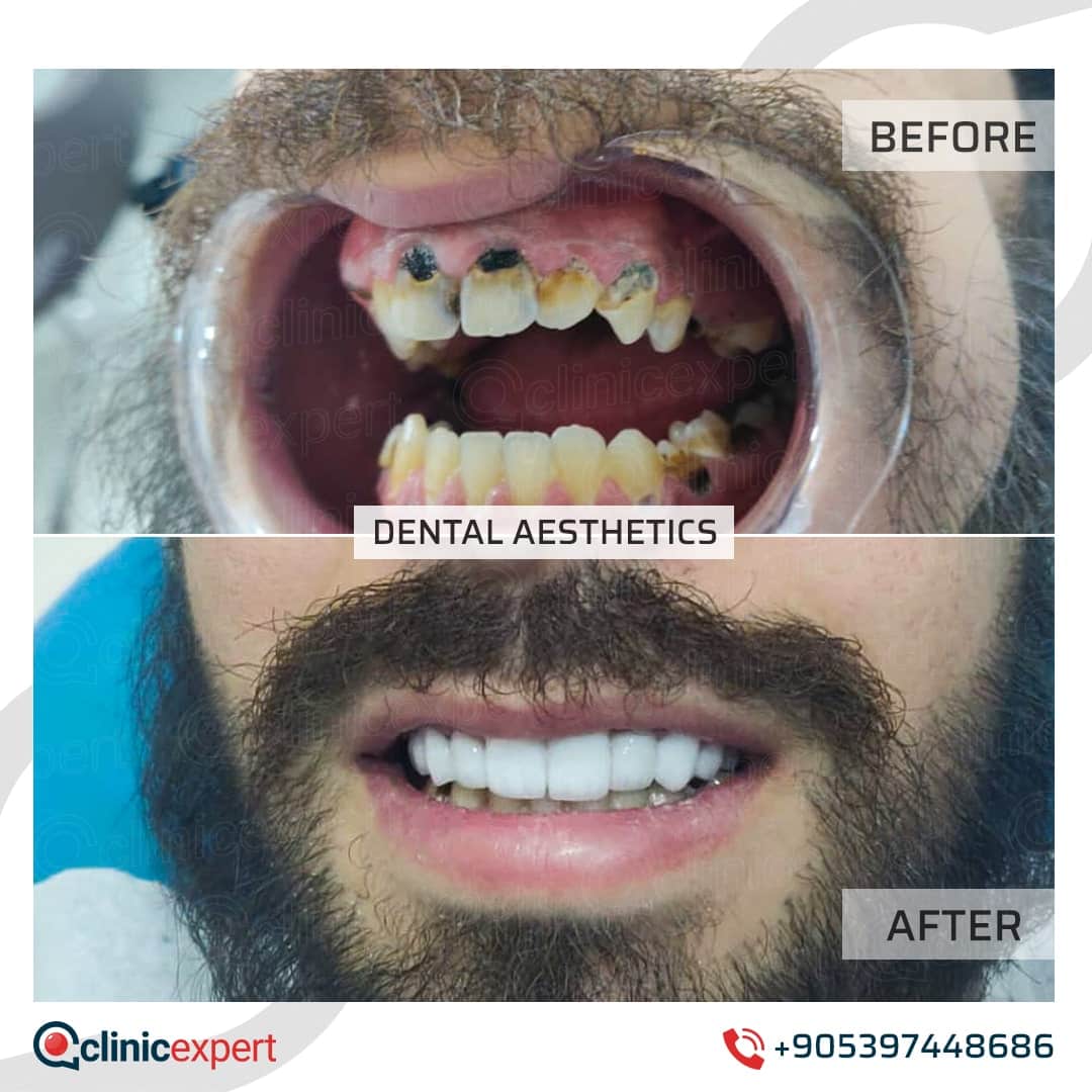 Dentistry Patients 29