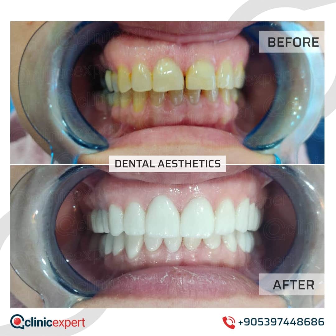 Dentistry Patients 30
