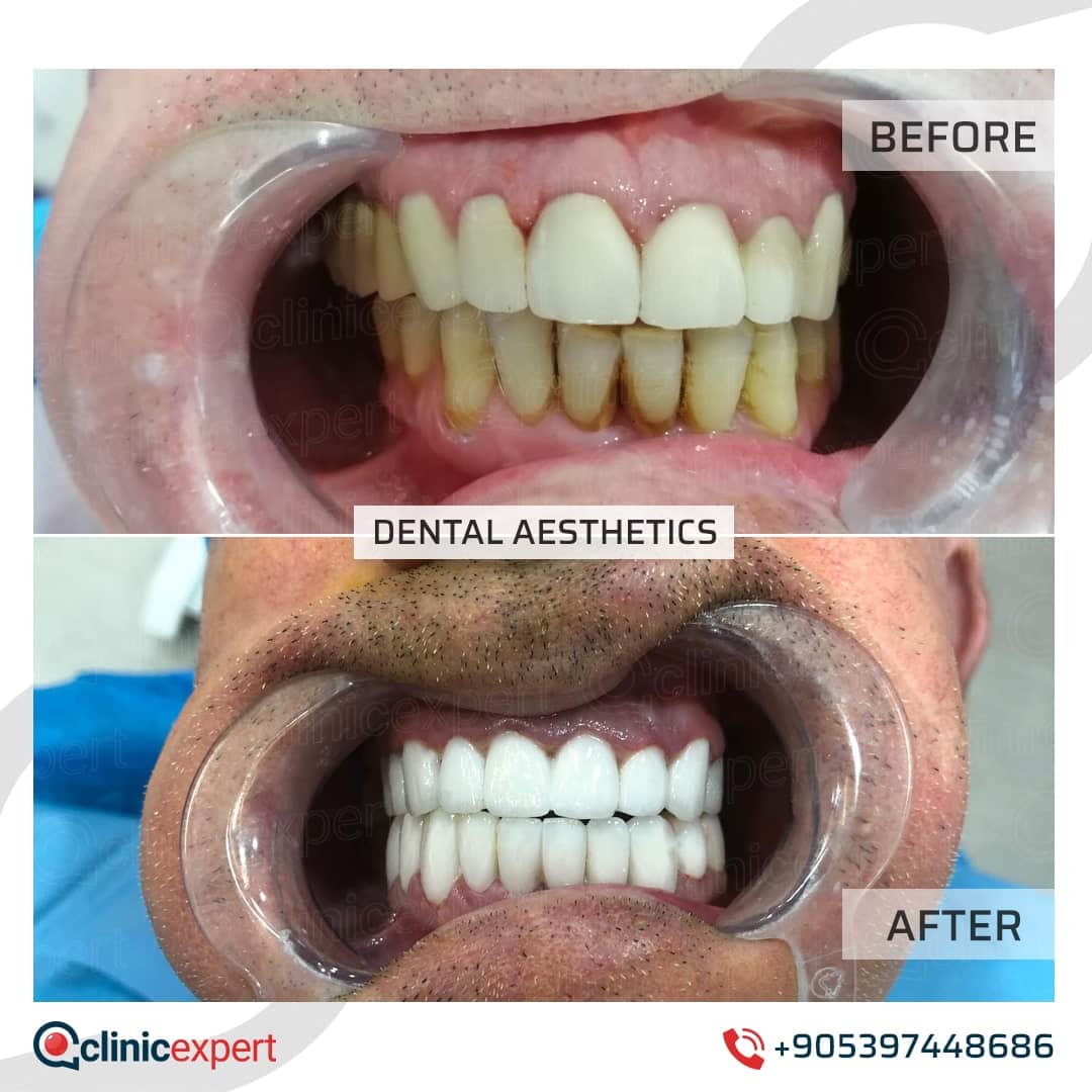Dentistry Patients 31