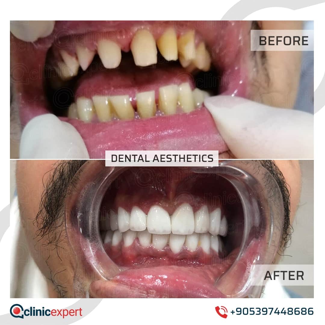 Dentistry Patients 32