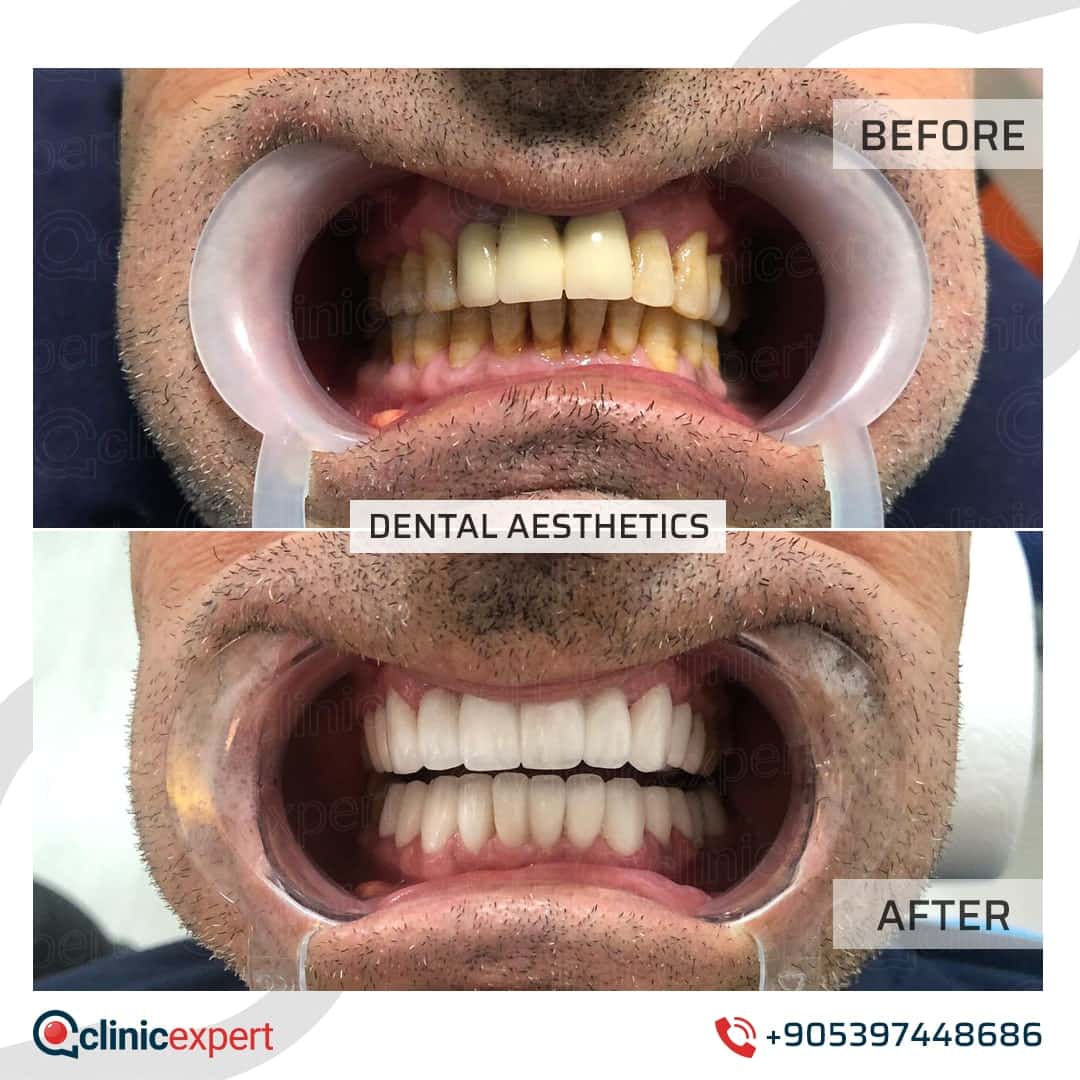 Dentistry Patients 33