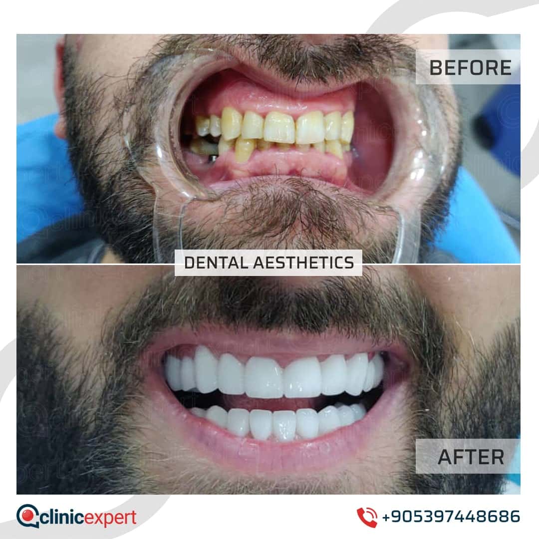 Dentistry Patients 34