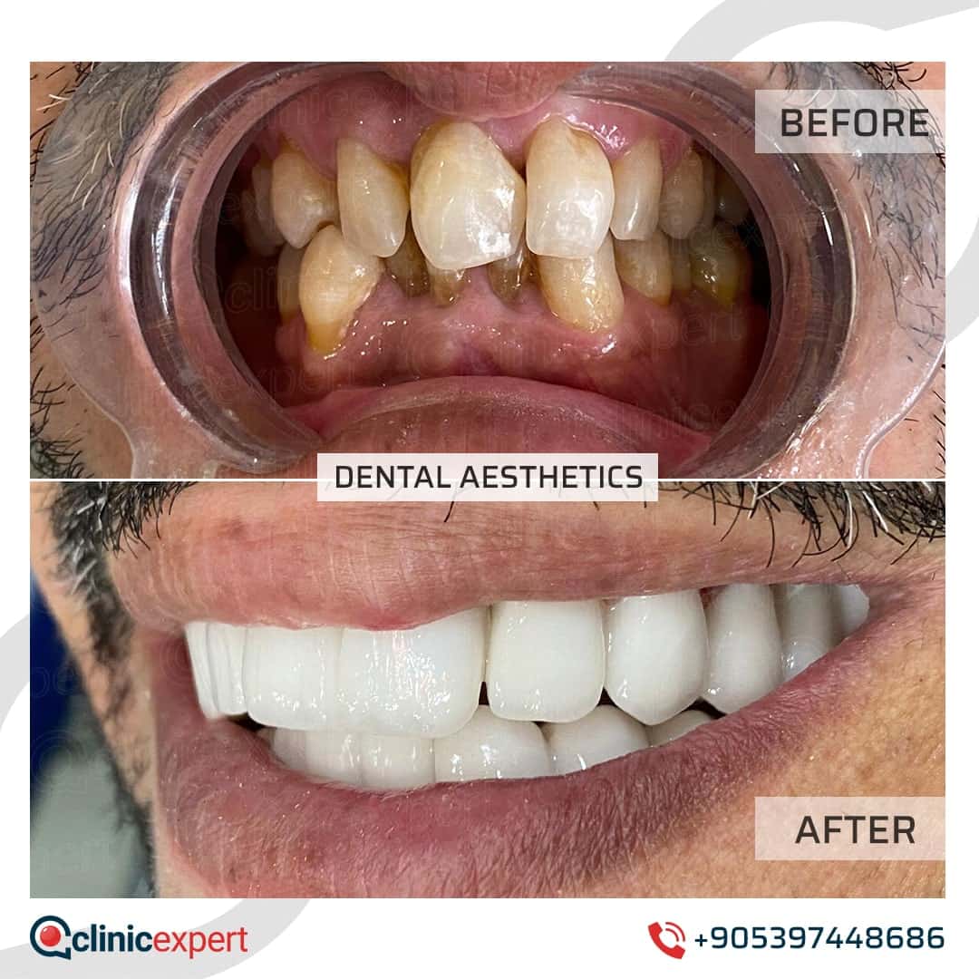 Dentistry Patients 20
