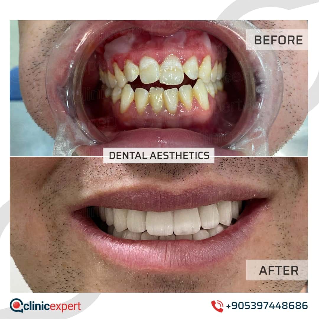Dentistry Patients 21