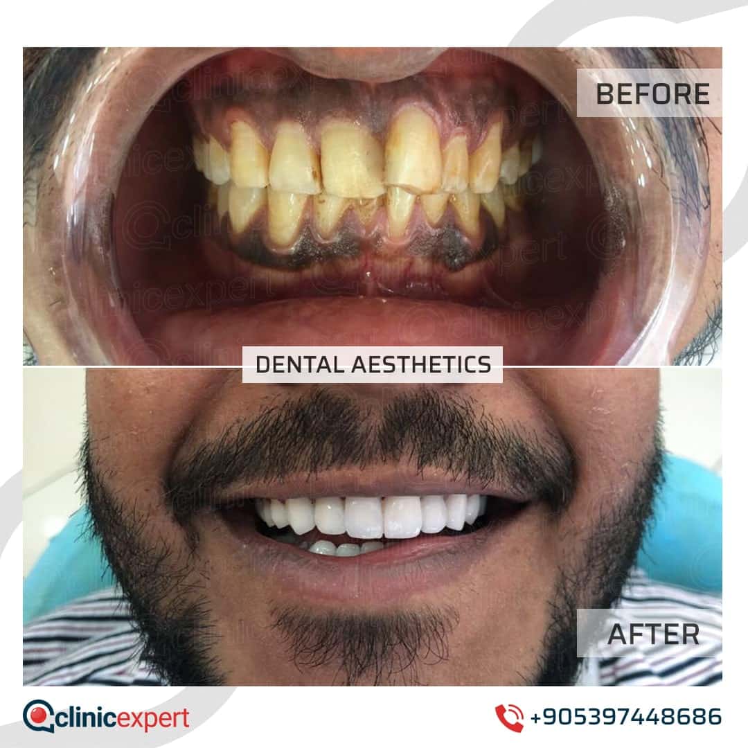 Dentistry Patients 22