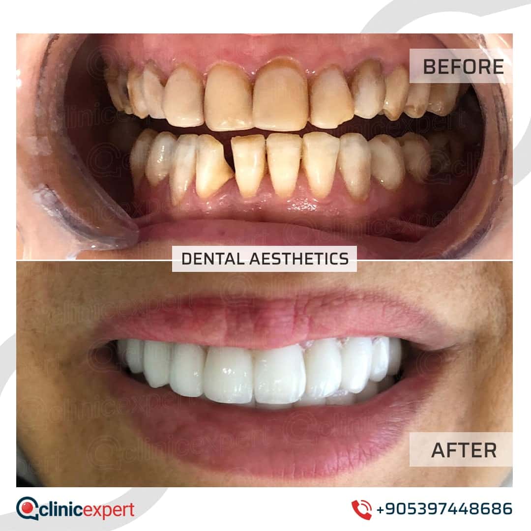 Dentistry Patients 23