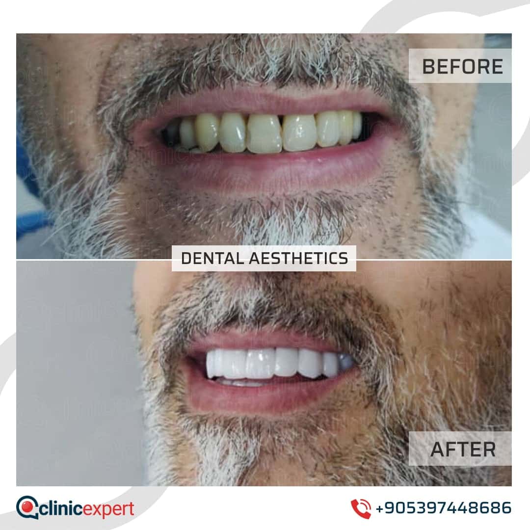 Dentistry Patients 24
