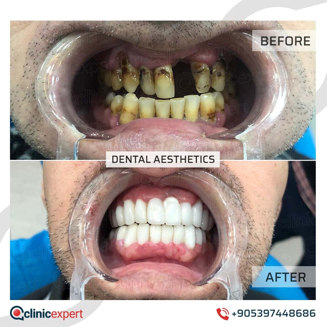 Dentistry Patients 26