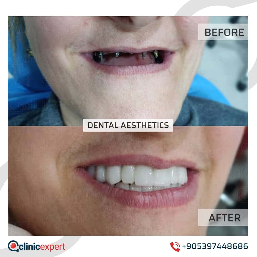 Dentistry Patients 28