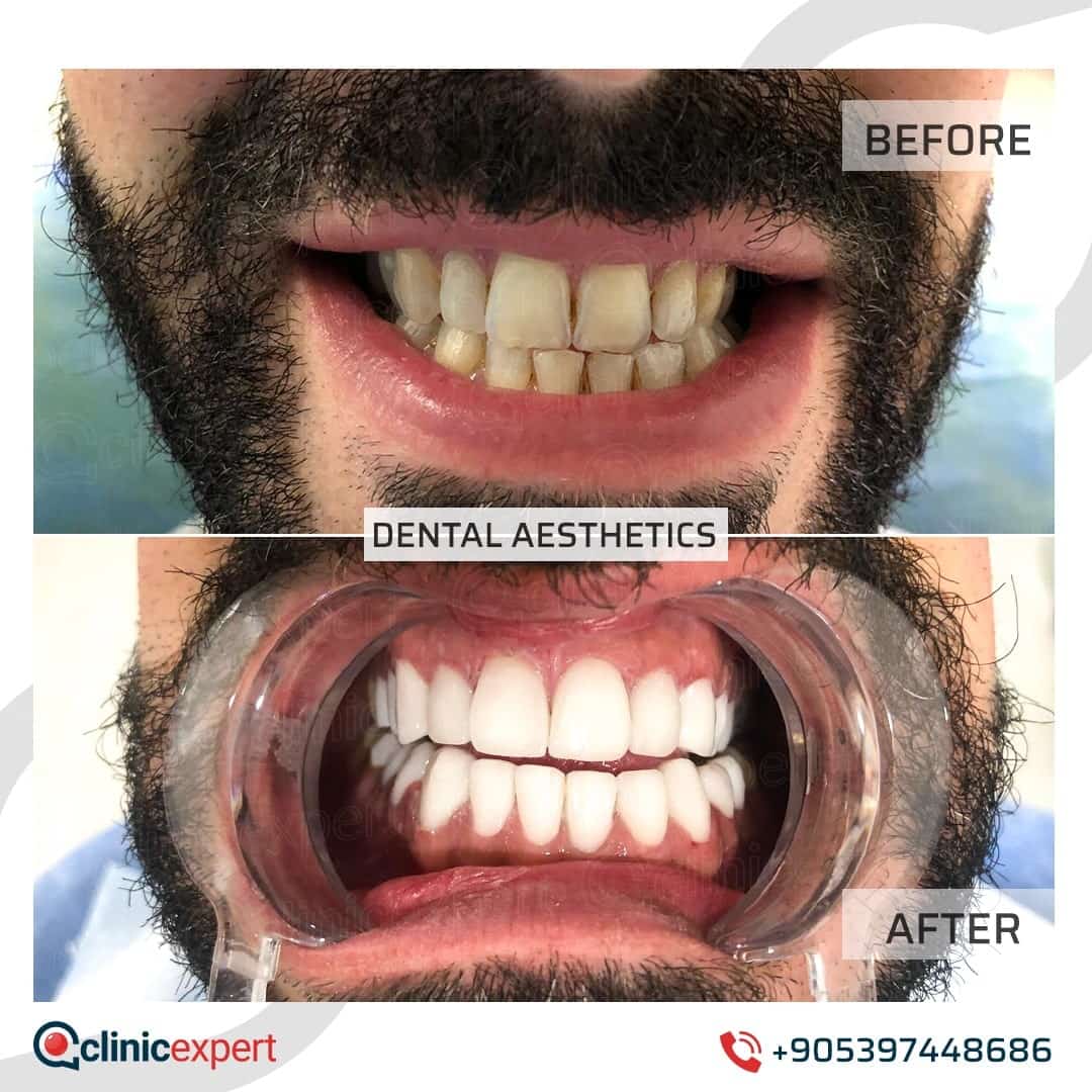 Dentistry Patients 35