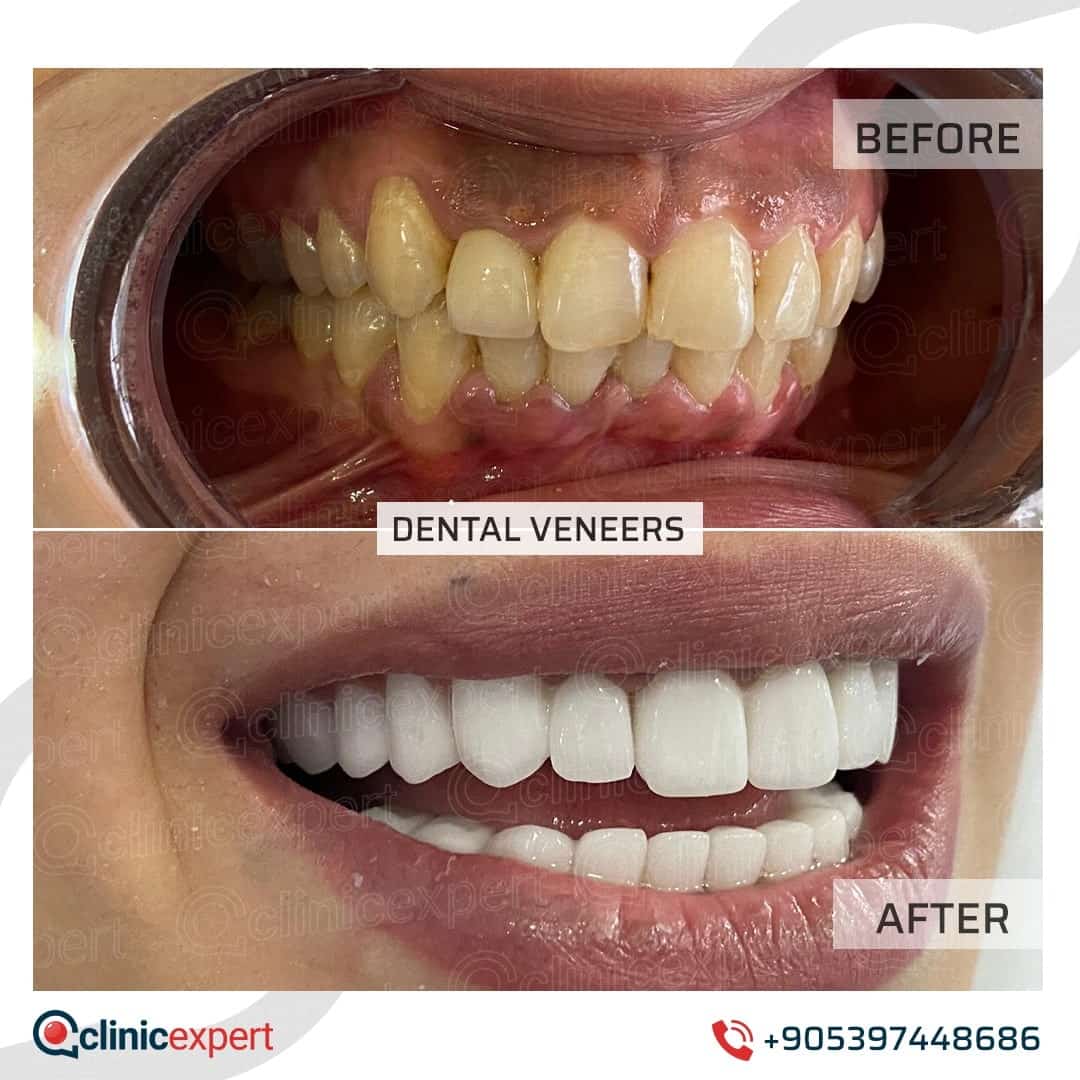 Dentistry Patients 36