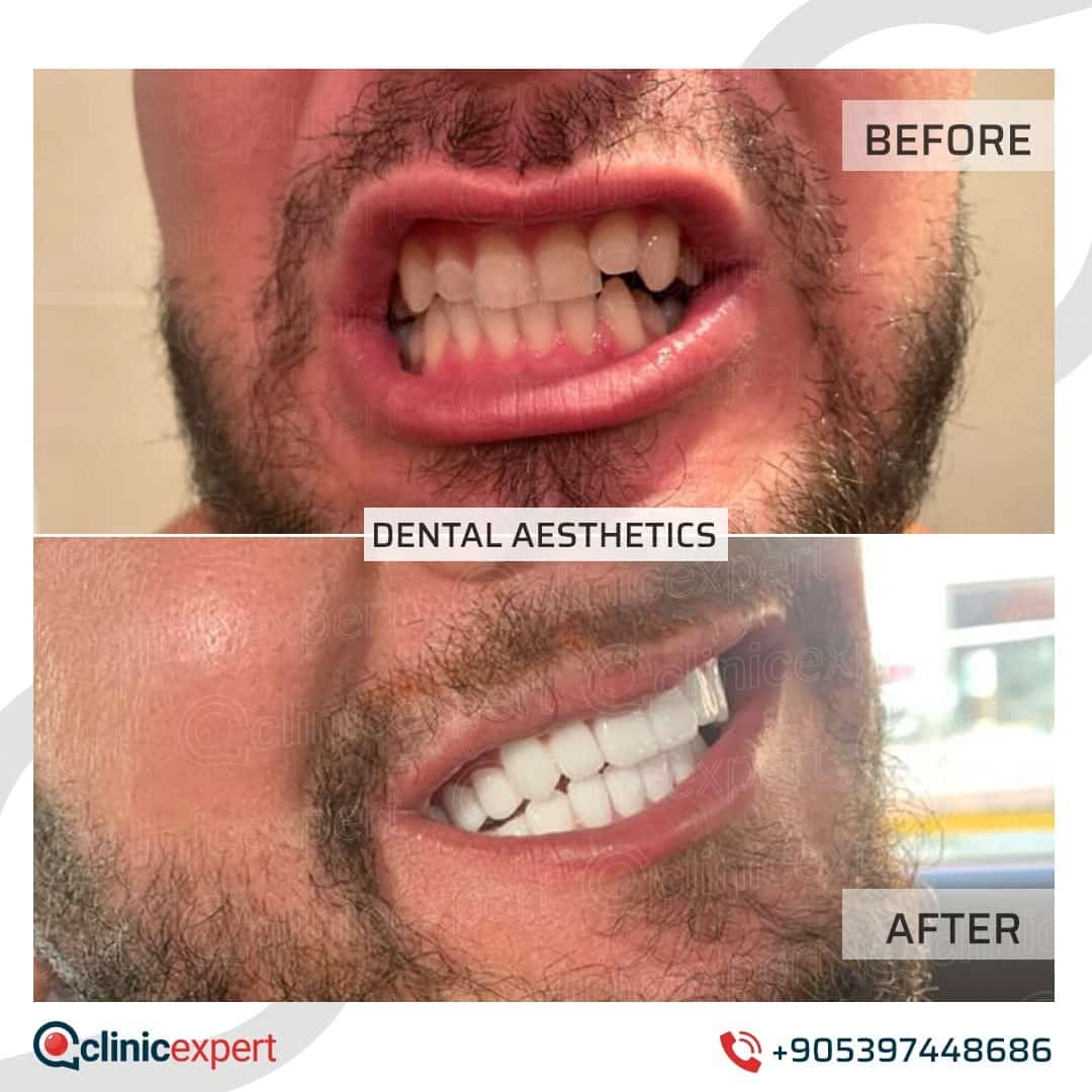 Dentistry Patients 37