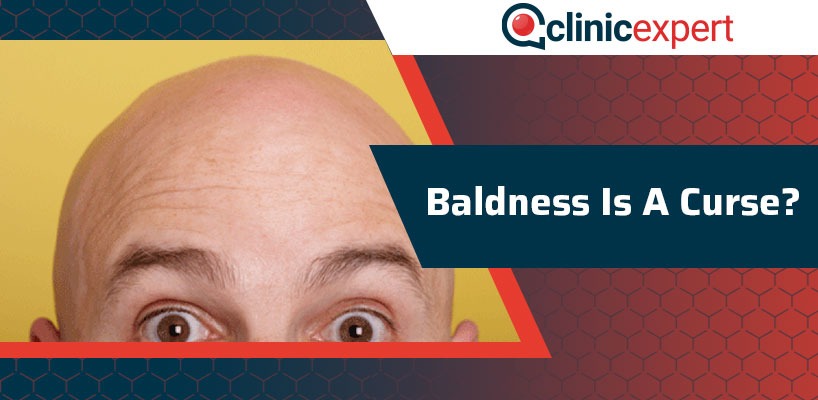 Baldness Is A Curse?