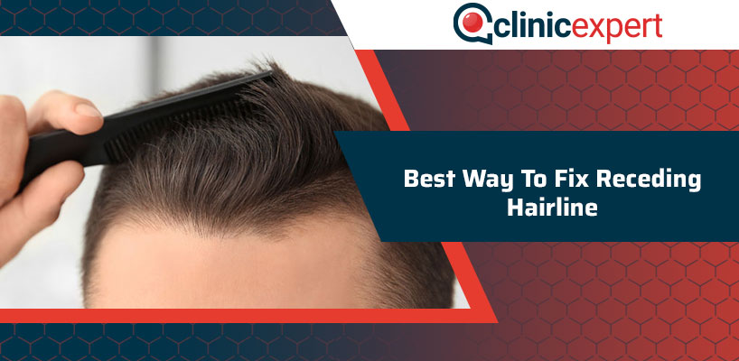 Best Way To Fix Receding Hairline