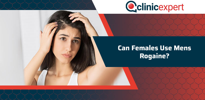 Can Females Use Men's Rogaine?