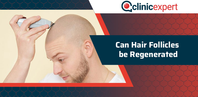 Can Hair Follicles be Regenerated?