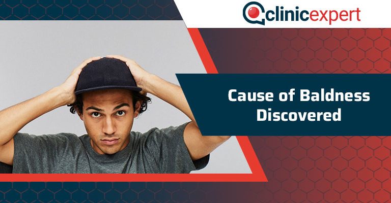 Cause of Baldness Discovered