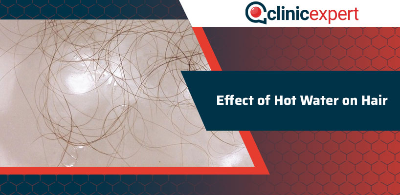 Effect of Hot Water on Hair