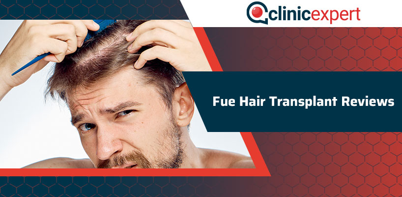 Fue Hair Transplant Reviews