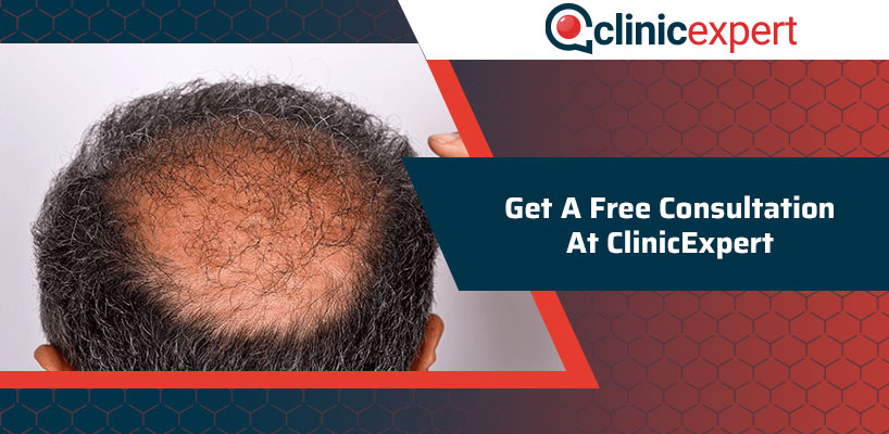 Get A Free Hair Consultation At ClinicExpert