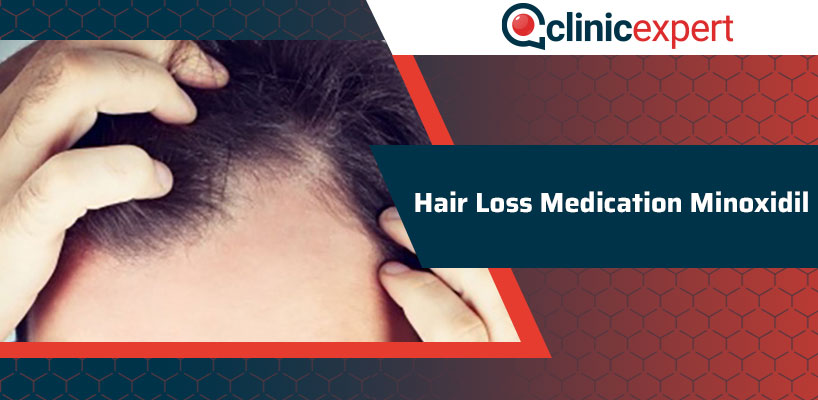 Hair Loss Medication Minoxidil