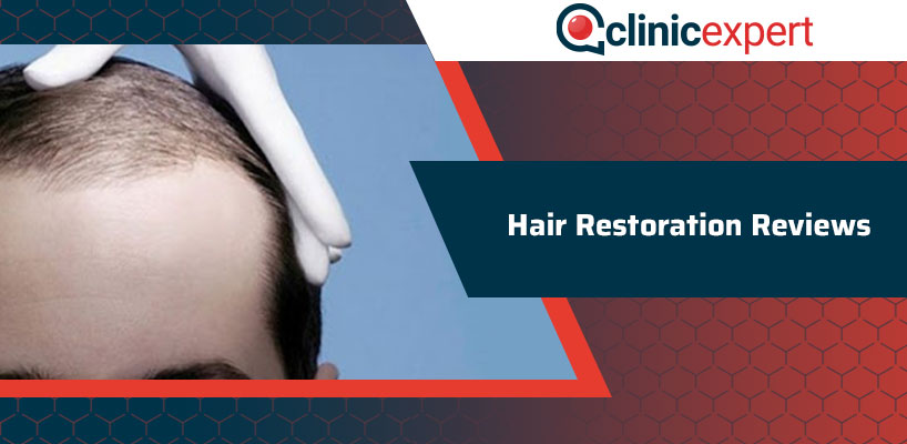 Hair Restoration Reviews