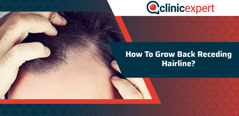 How To Grow Back Receding Hairline? 