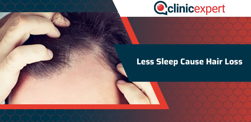 Less Sleep Cause Hair Loss?