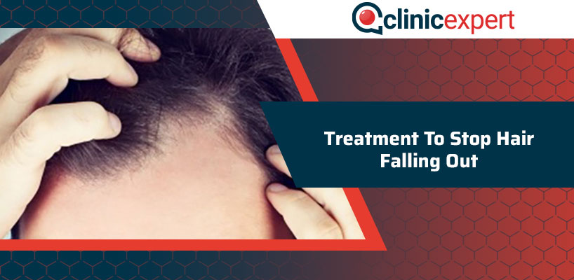 Treatment To Stop Hair Falling Out 