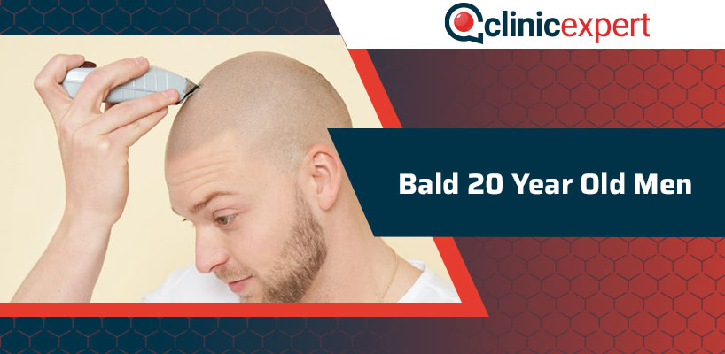 Bald 20 Year Old Men