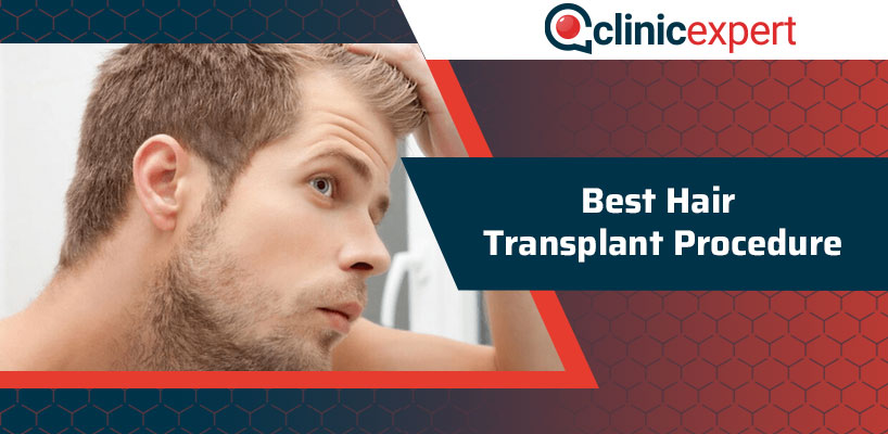 Best Hair Transplant Procedure