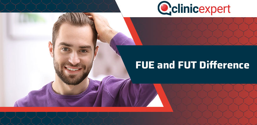 FUE and FUT Difference