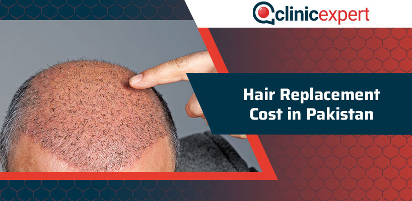 Hair Replacement Cost In Pakistan