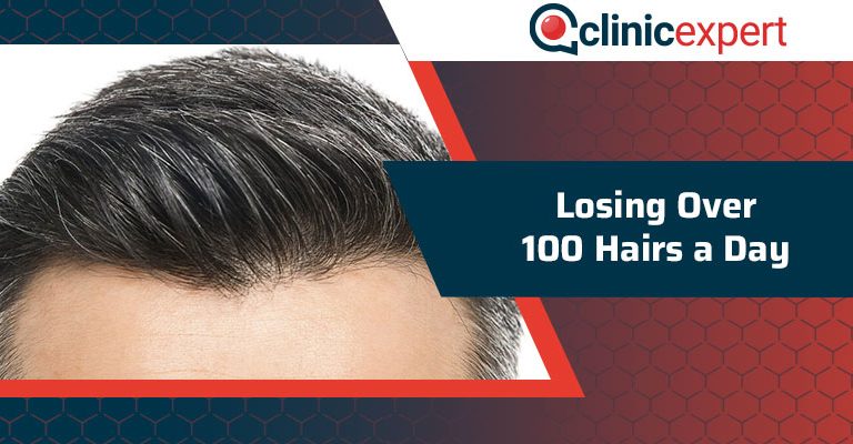 Losing Over 100 Hairs a Day