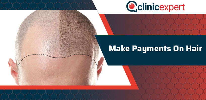 Make Payments On Hair