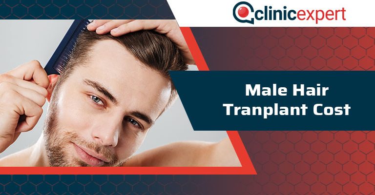 Male Hair Transplant Cost