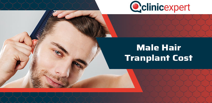 Male Hair Transplant Cost | Hair Transplant ClinicExpert